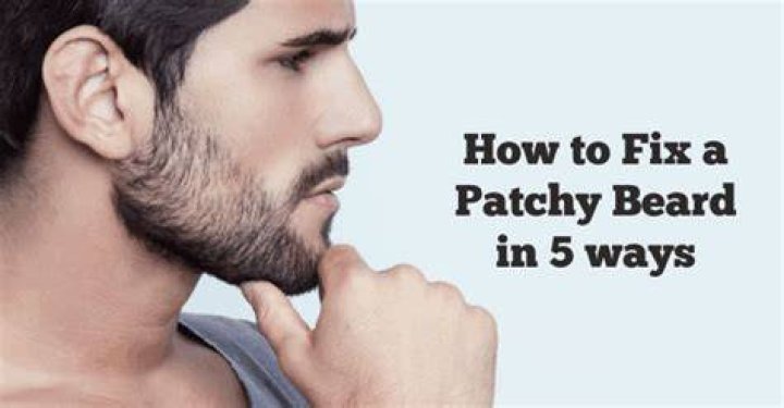 Can patchy beard be fixed?