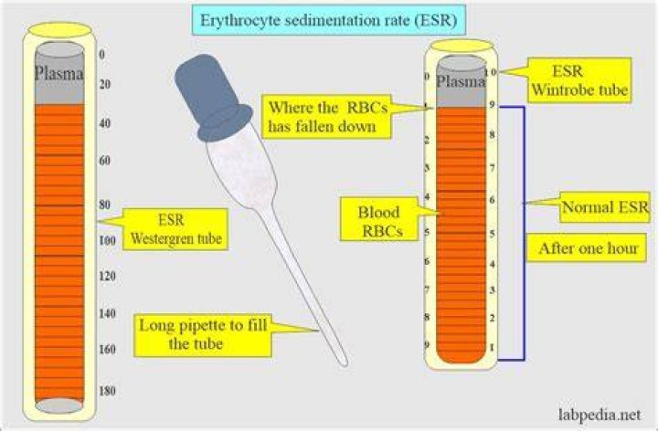 How to lower sedimentation rate?
